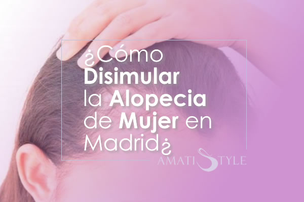 Cómo Disimular la Alopecia de Mujer en Madrid